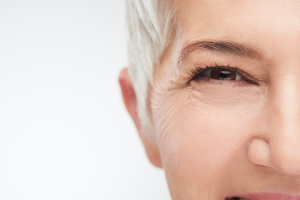 Am I a Good Blepharoplasty Candidate?