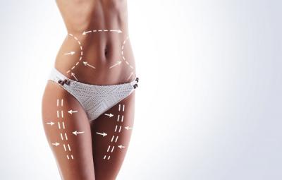Target areas for liposuction