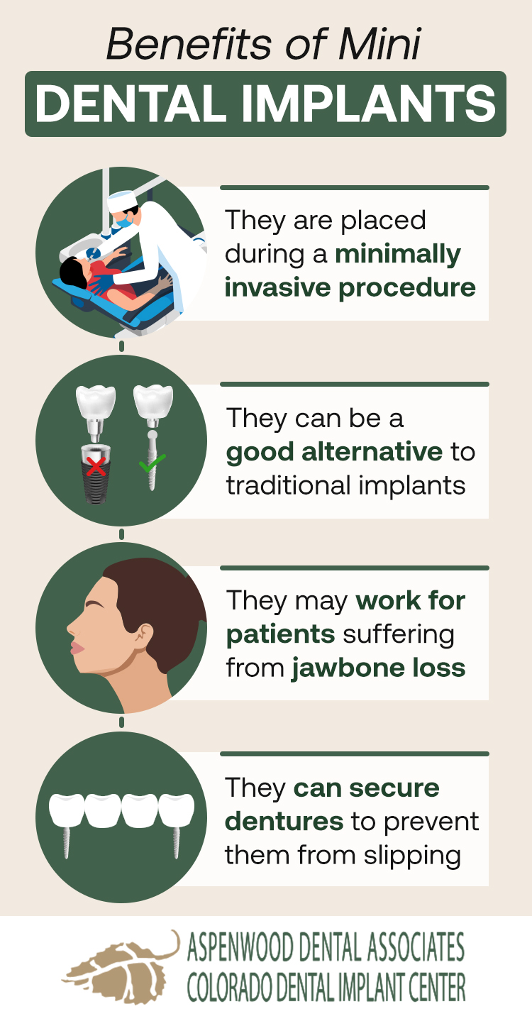 Mini Dental Implants Aurora, Colorado Denver Mini Implants