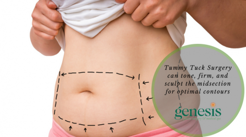 Tummy Tuck in Oklahoma City