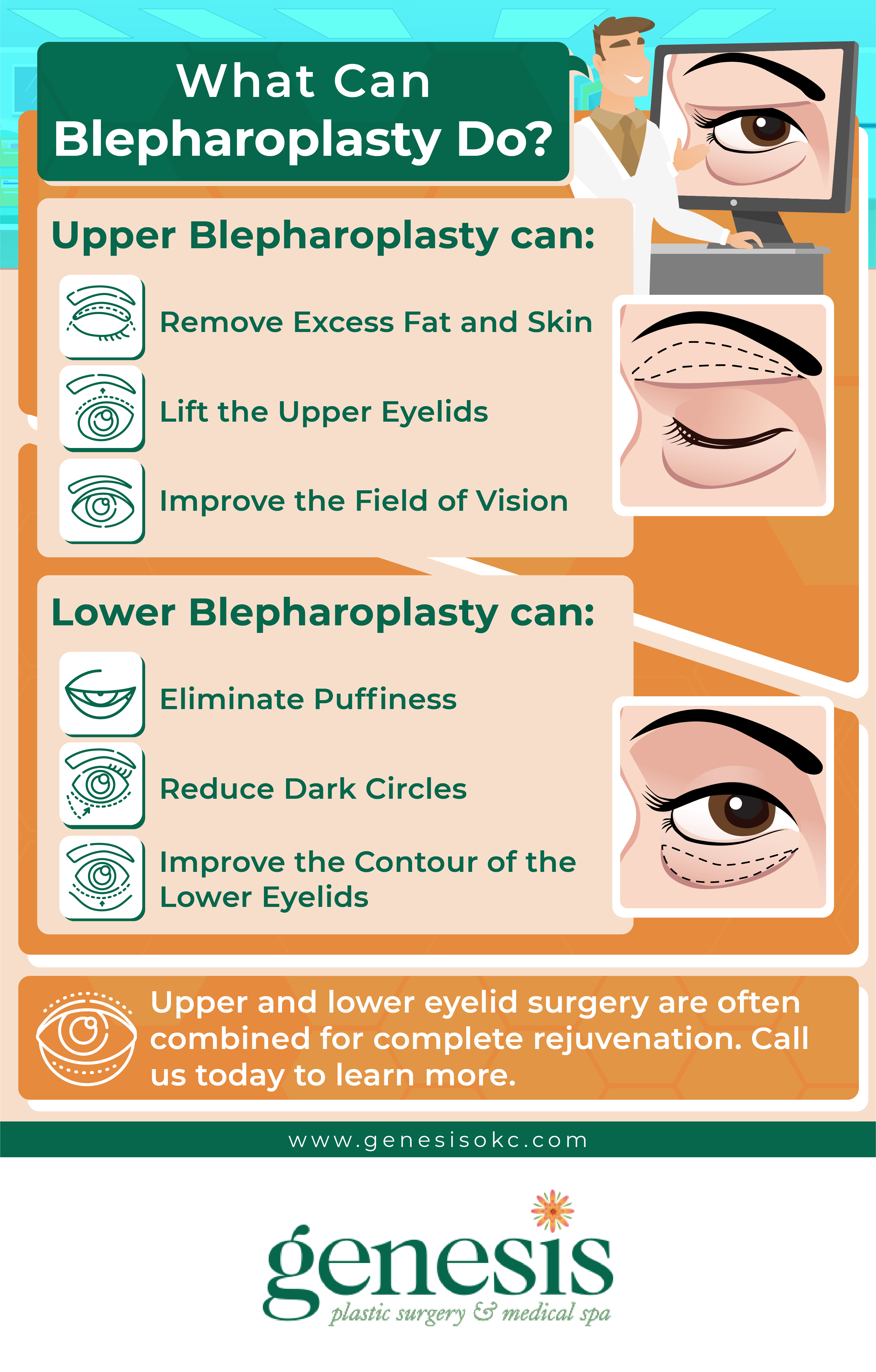 Benefits of Eyelid Surgery Infographic