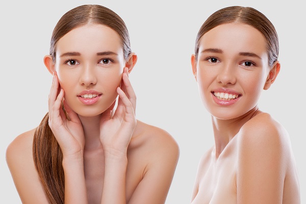Otoplasty Before and After