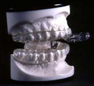 Thornton Adjustable Positioner (TAP) in model of human mouth