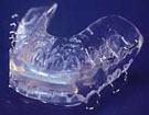 Clasp Retained Mandibular Positioner