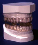 Sleep Apnea Goldilocks Appliance