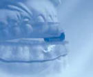Medical Dental Sleep Appliance
