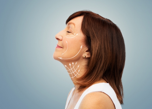 What Is A Smas Facelift Bryn Mawr Philadelphia Pa