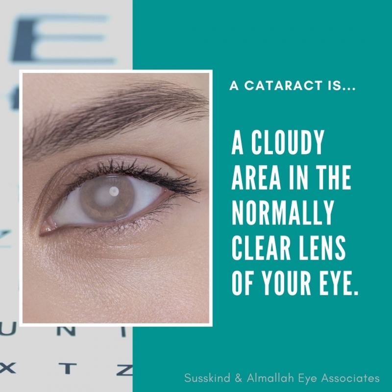 Cataract definition | Toms River