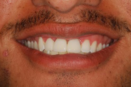 Fix My Smile in Washington DC