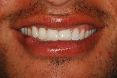 Fix My Smile in Washington DC