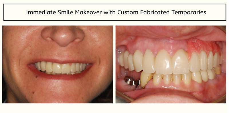Woman during smile makeover treatment in D.C.