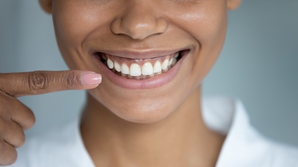 Woman smiling and pointing at teeth