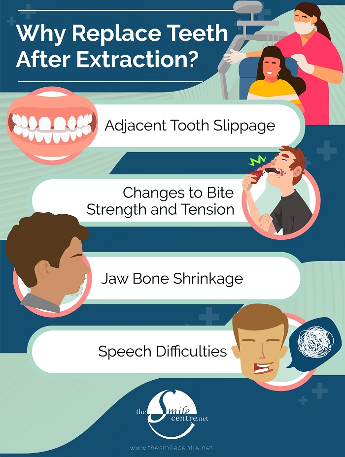 Infographic: Why Replace Missing Teeth?