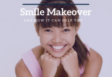 Smile Makeover