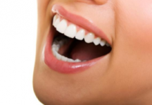 Need Teeth Whitening?